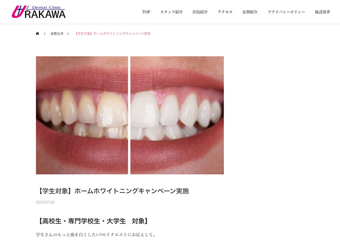 うらかわ歯科医院【〈学生対象〉ホームホワイトニングキャンペーン】